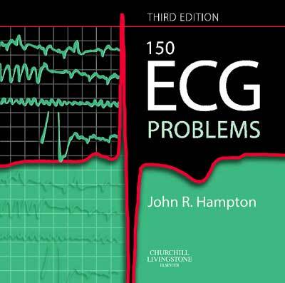 150 ECG Problems